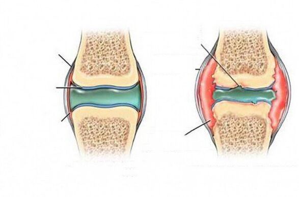 The process of deforming joints